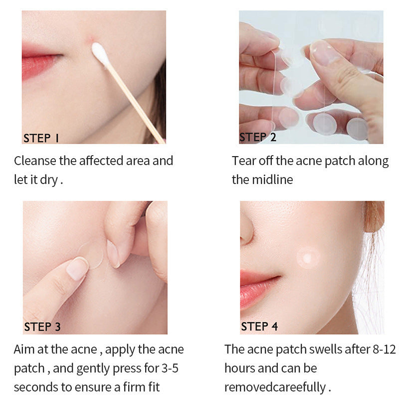 BlemishBuster - 3x Infused with salicylic acid®